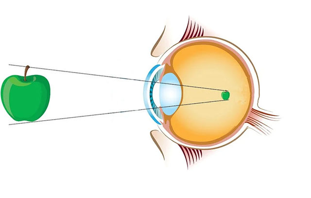 Đáp án Cuộc thi chăm sóc mắt và phòng chống suy giảm thị lực ở học sinh năm 2024 Hội thi chăm sóc mắt cho học sinh Tiểu học, THCS